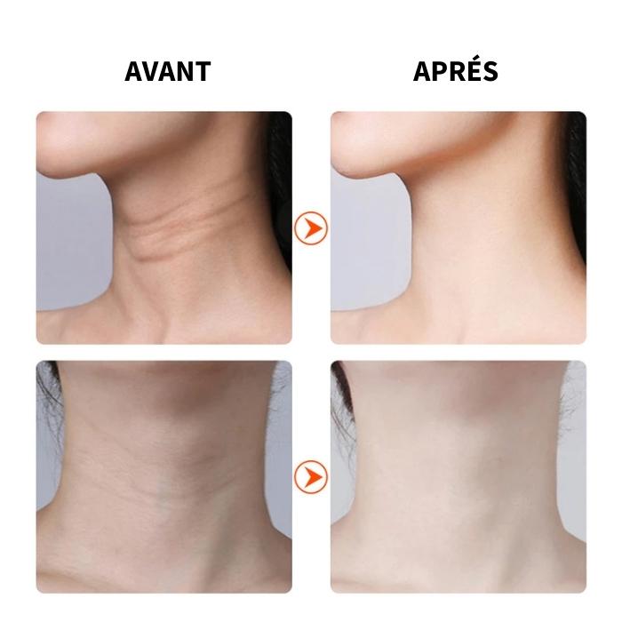 ELIX LIFT - Appareil de Lifting Visage & Cou à Domicile