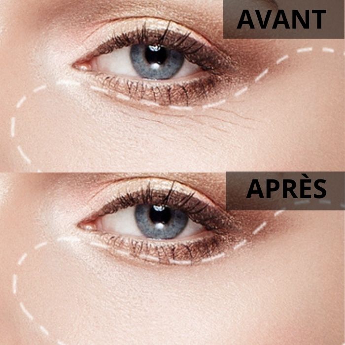 Parches antiojeras con colágeno de oro de 24k (60 piezas/caja)